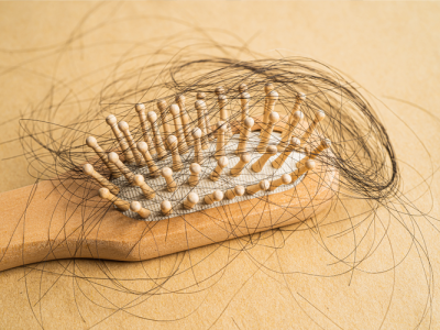 Rontoknya Rambut