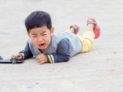 Patah Tulang Pada Anak Yang Sering Tak Di Sadari Orangtua