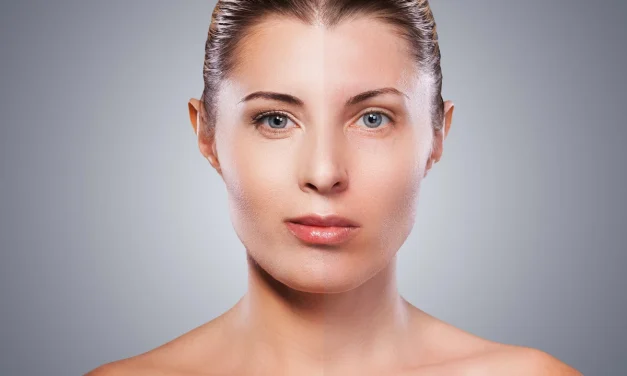 Solusi Kulit Sehat Optimal Lewat Skin Cycling